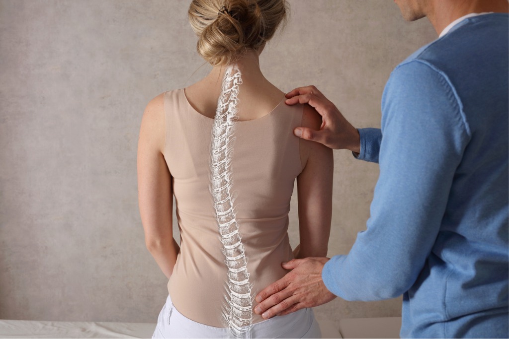 harrington-rod-vs-growing-rod-the-evolution-of-scoliosis-treatment