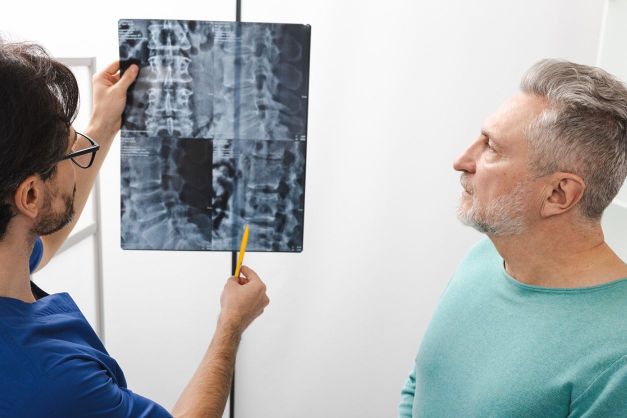 Degenerative Scoliosis Causes, Symptoms, and Treatment Options
